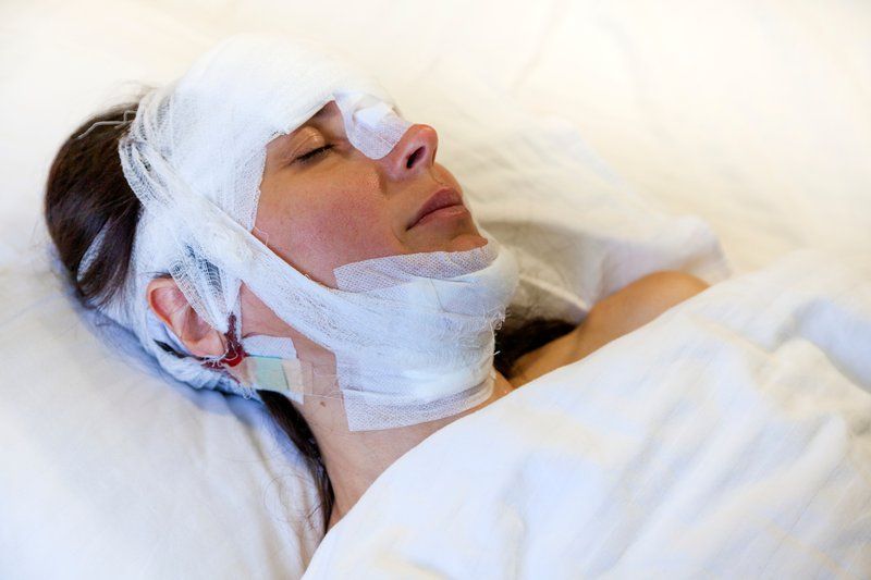 A woman lies in bed with bandages covering her head, nose, chin, and neck, eyes closed, appearing to be recovering from brain injuries after surviving the impact of a serious car accident.
