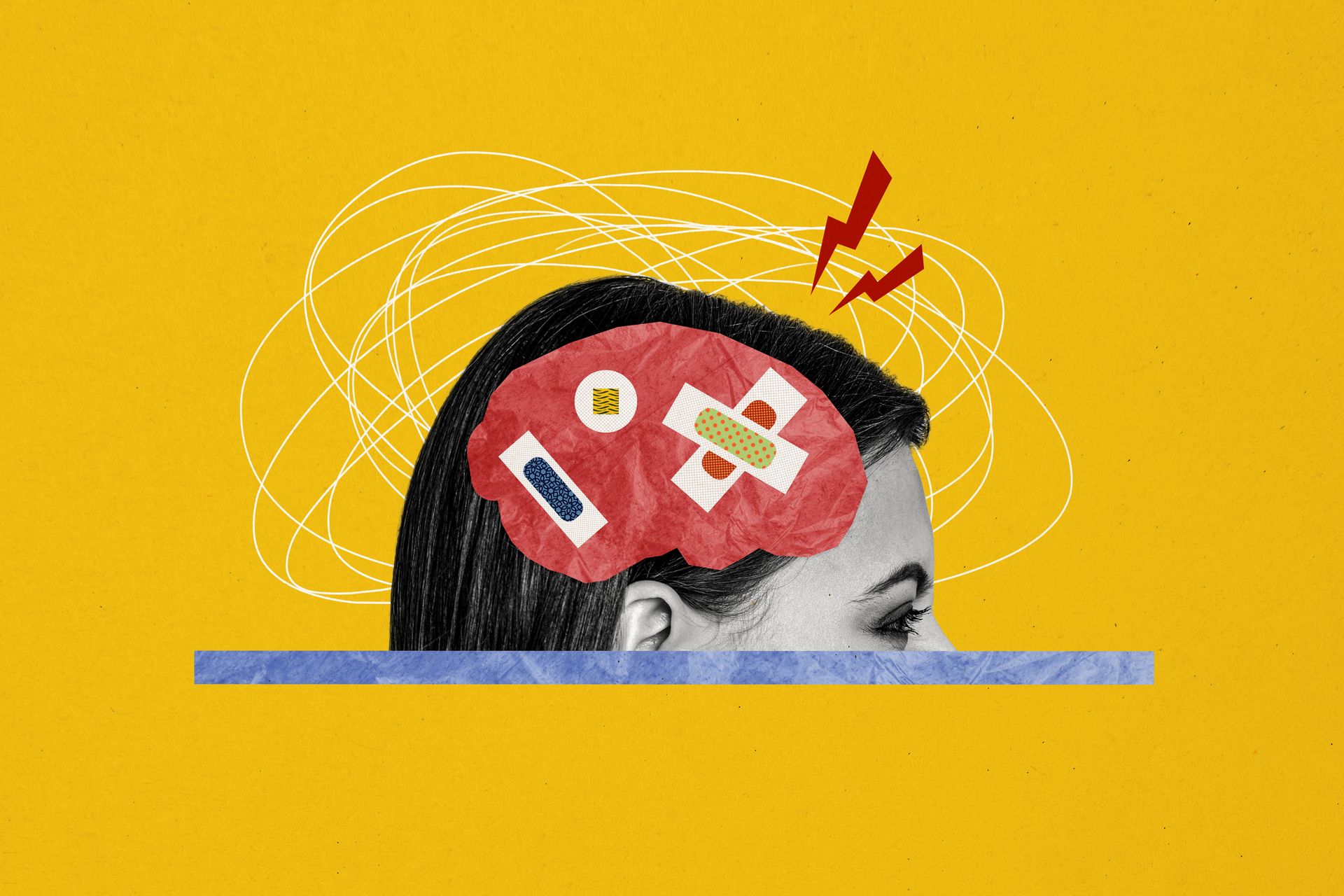Illustration of a woman’s head with bandages on her brain, chaotic lines, and red lightning bolts, symbolizing the differences in mental health struggles or stress related to conditions like Alzheimer’s.