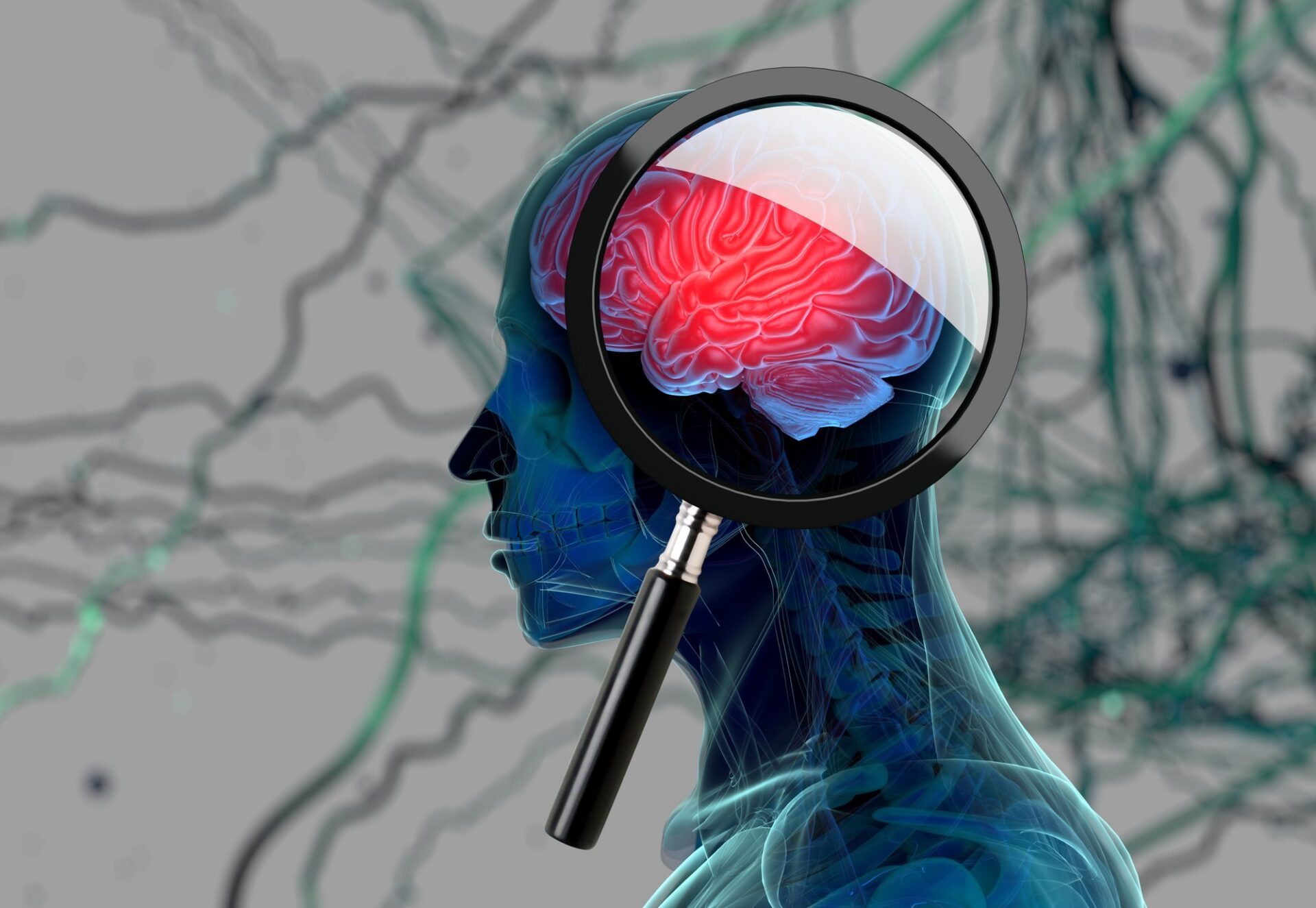 parkinsons research
